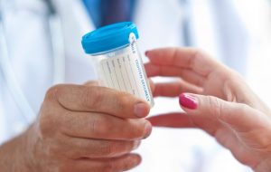 Right Urine Temperature for Drug Tests